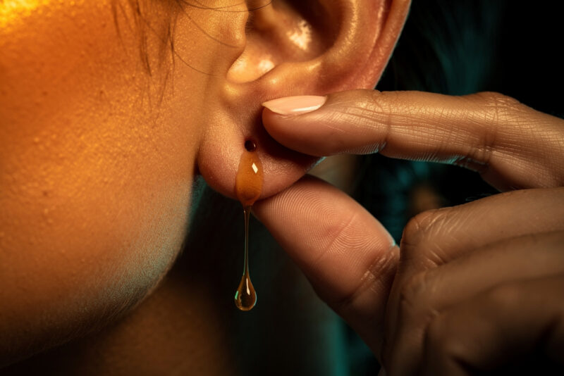 Comment reboucher un trou d'oreille naturellement ?